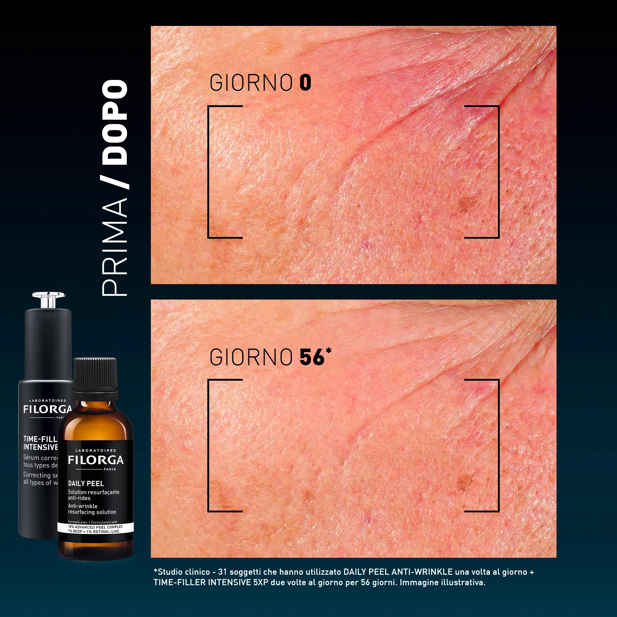 DAILY PEEL ANTI-WRINKLE - Image 12