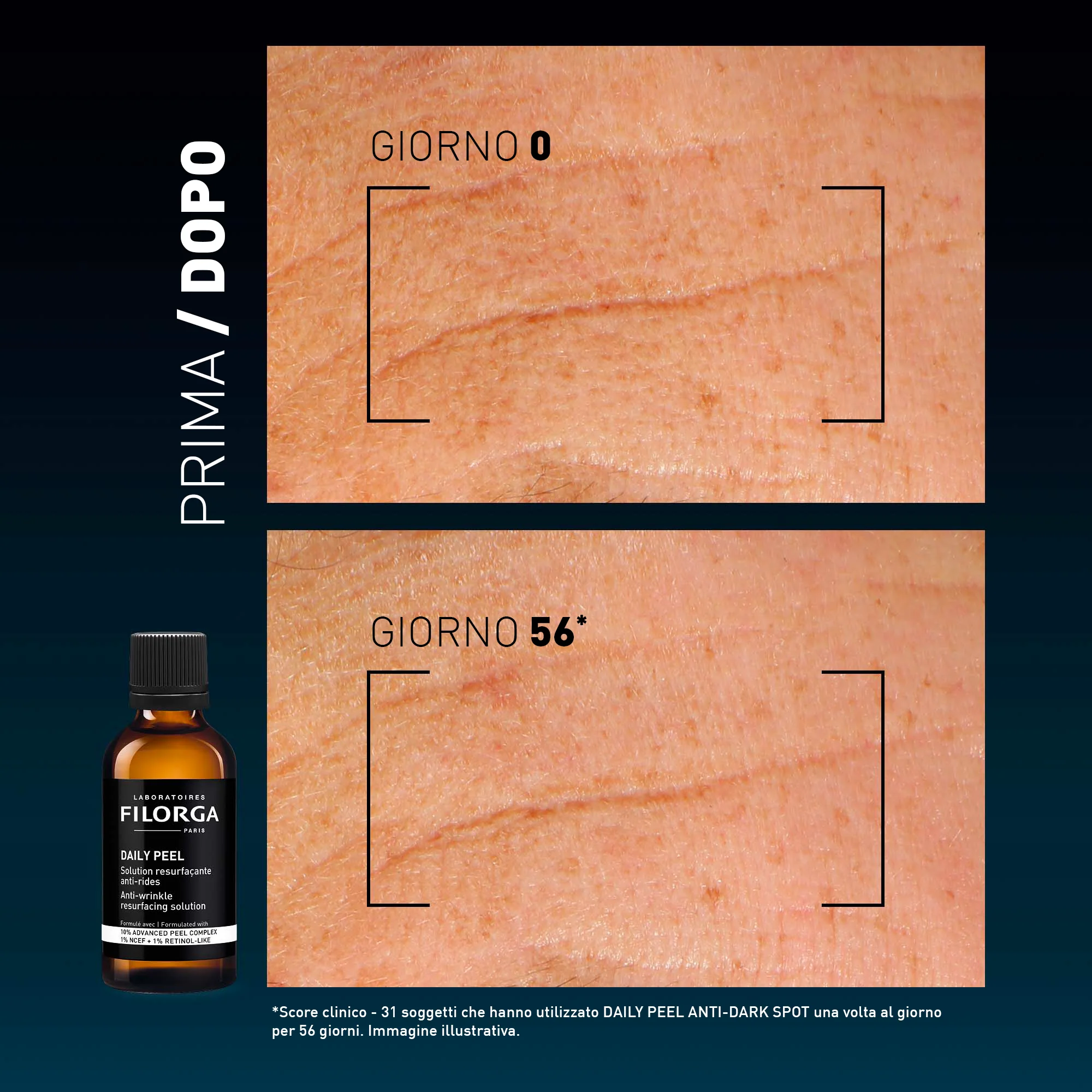 DAILY PEEL ANTI-WRINKLE - Image 8