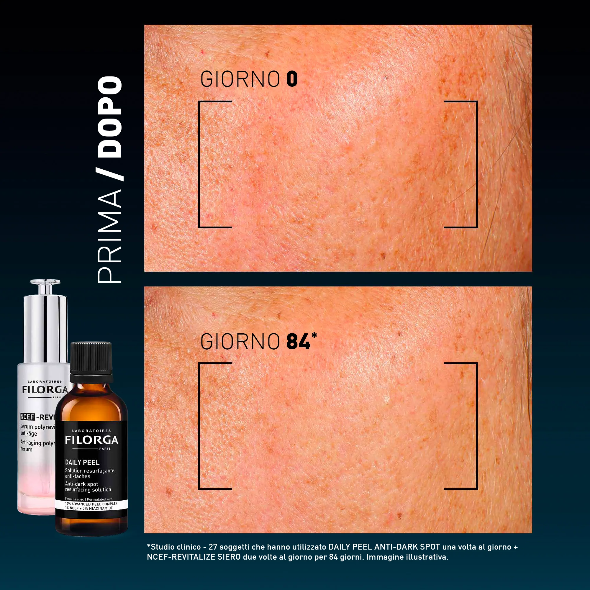 DAILY PEEL ANTI-DARK SPOT - Image 12
