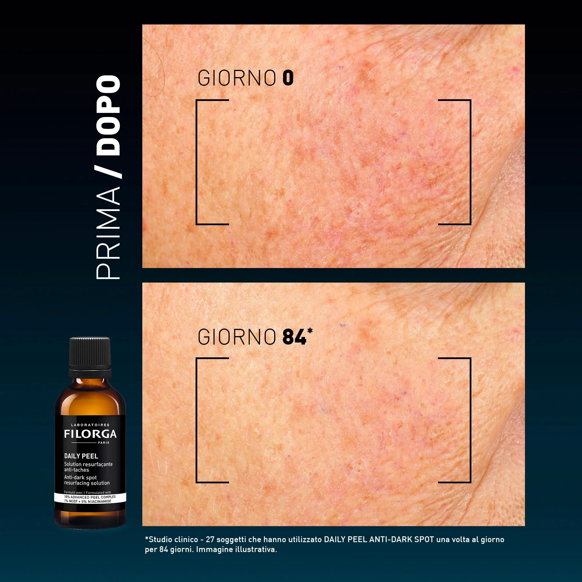 DAILY PEEL ANTI-DARK SPOT - Image 8